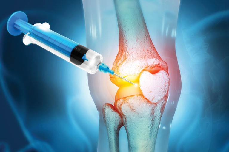 Increasing Incidence Of Bone And Joint Disorders And Orthopedic Surgeries Are Key Drivers For Global Cartilage Repair/ Cartilage Regeneration Market